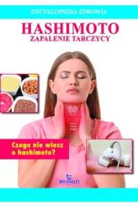 ENCYKLOPEDIA ZDROWIA.HASHIMOTOZAPALENIE TARCZYCY